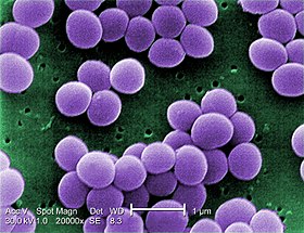 280px Staphylococcus Aureus Visa 2